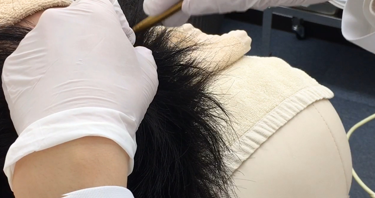 明石で薄毛治療・AGA治療をお探しの方々も姫路のCLクリニックへ
